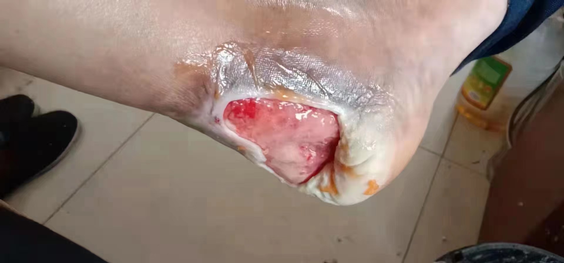 6e3200e36d1e21207bb2b55a6951fdd.jpg